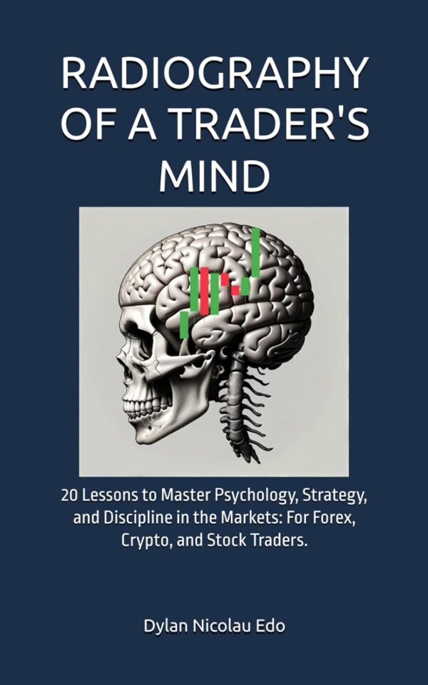 Radiography of a traders mind 20 lessons to master psychology.jpg